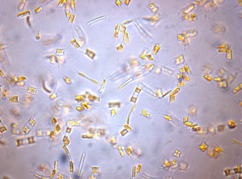 Mange små alger forstørret i mikroskop